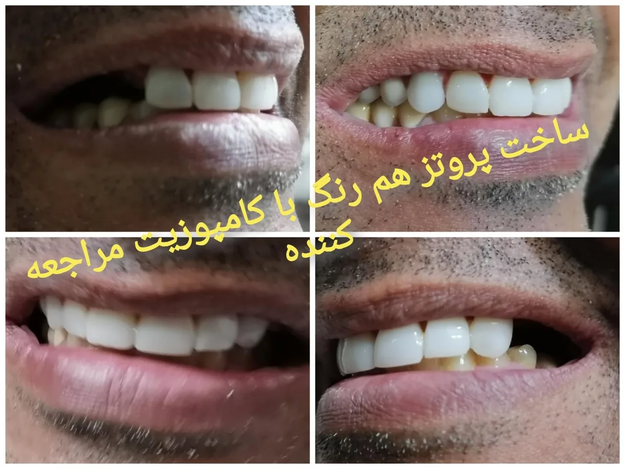دندانسازی صدرا - تصویر 3