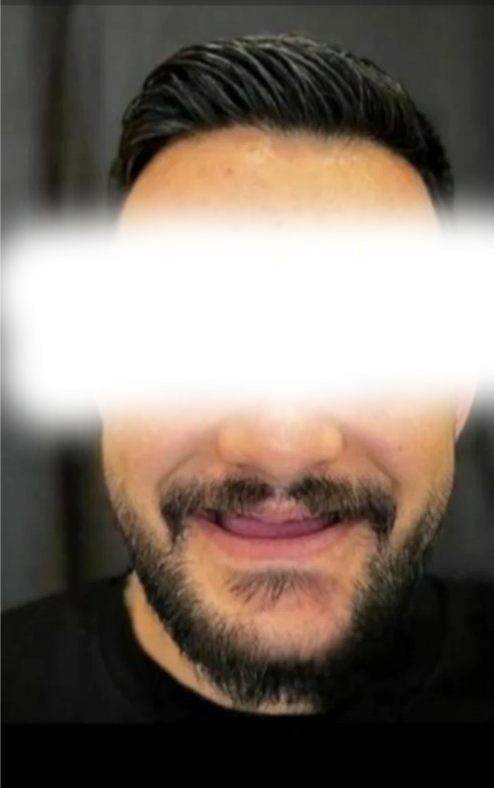 خدمات دندانپزشکی و دندانسازی احمدزاده - تصویر 3