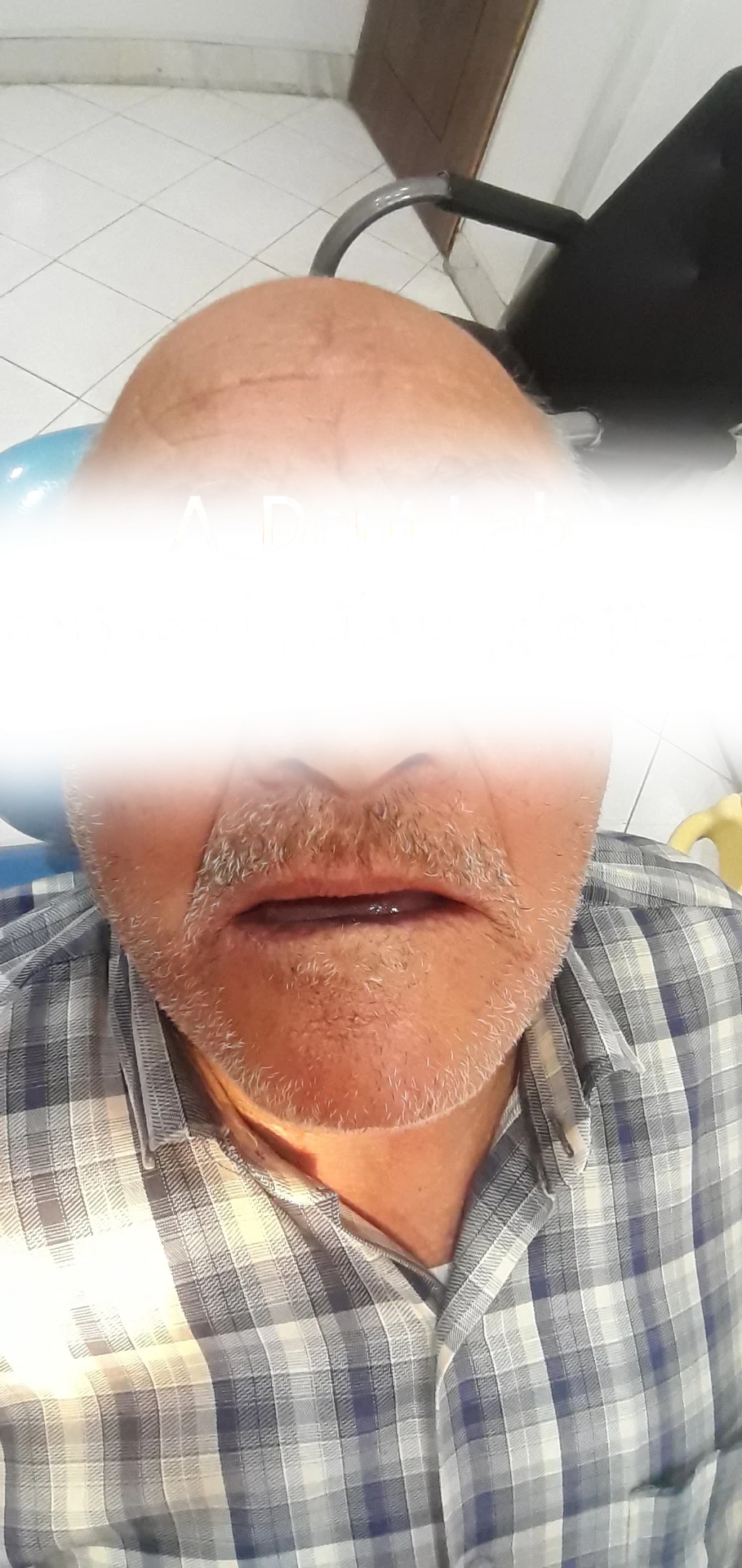 خدمات دندانپزشکی و دندانسازی احمدزاده - تصویر 4