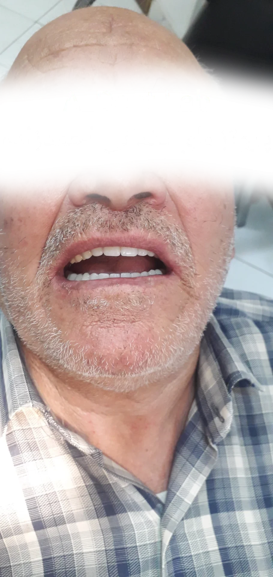 خدمات دندانپزشکی و دندانسازی احمدزاده - تصویر 5