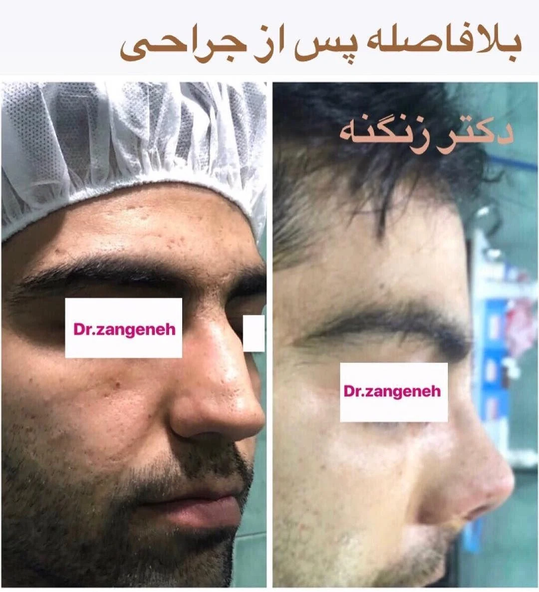 مطب جراح زیبایی دکتر حمیدرضا زنگنه