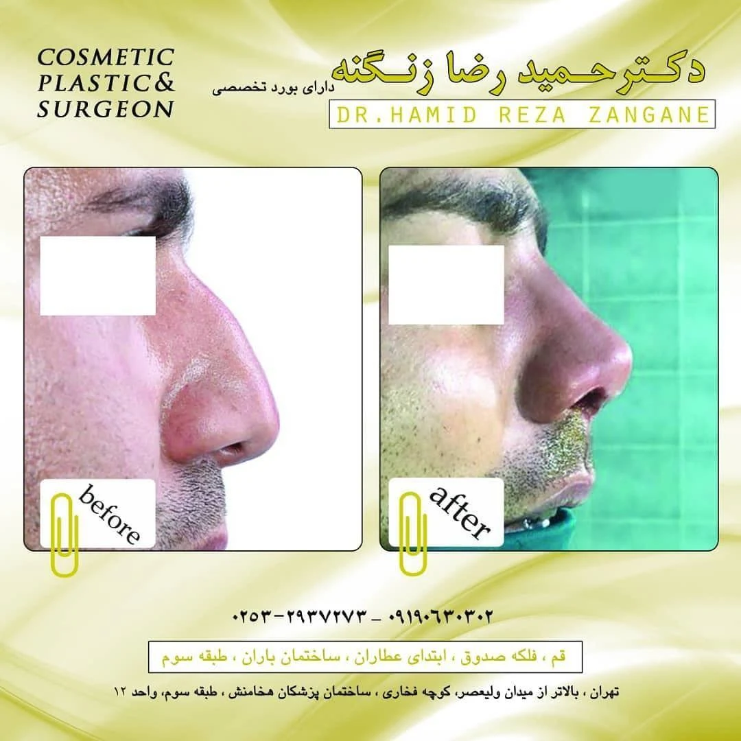 مطب جراح زیبایی دکتر حمیدرضا زنگنه - تصویر 2