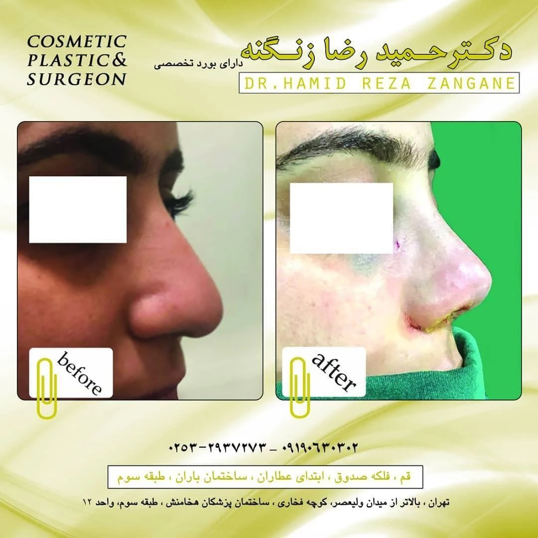 مطب جراح زیبایی دکتر حمیدرضا زنگنه - تصویر 3