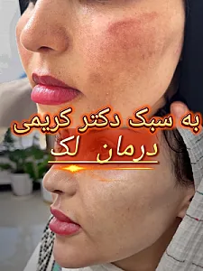 مطب زیبایی دکتر مصطفی کریمی