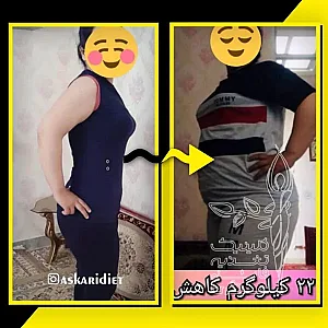 مطب فائزه عسکری