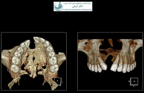 مرکز رادیولوژی دکتر شرفی