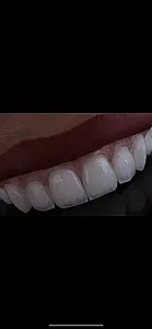 دکتر بهروز کریمی دندانپزشک