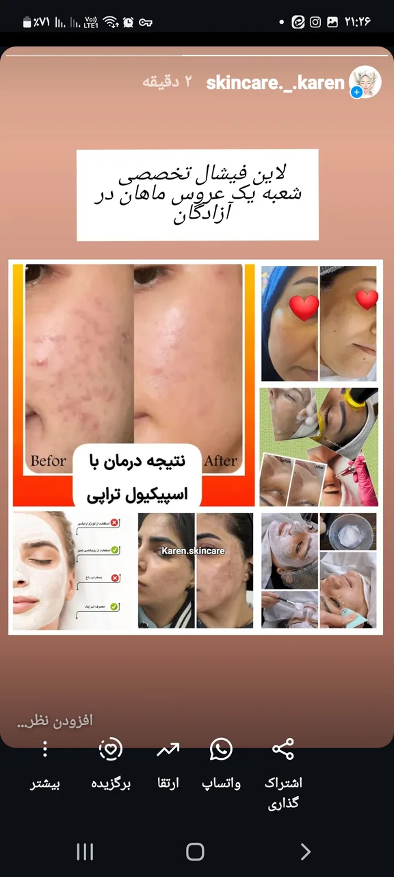 فیشال و پاکسازی پوست کارن - تصویر 2