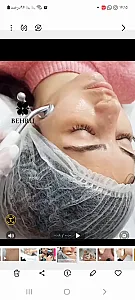 فیشیال وپاکسازی