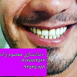 دندان سازی تخصصی معصوم زاده