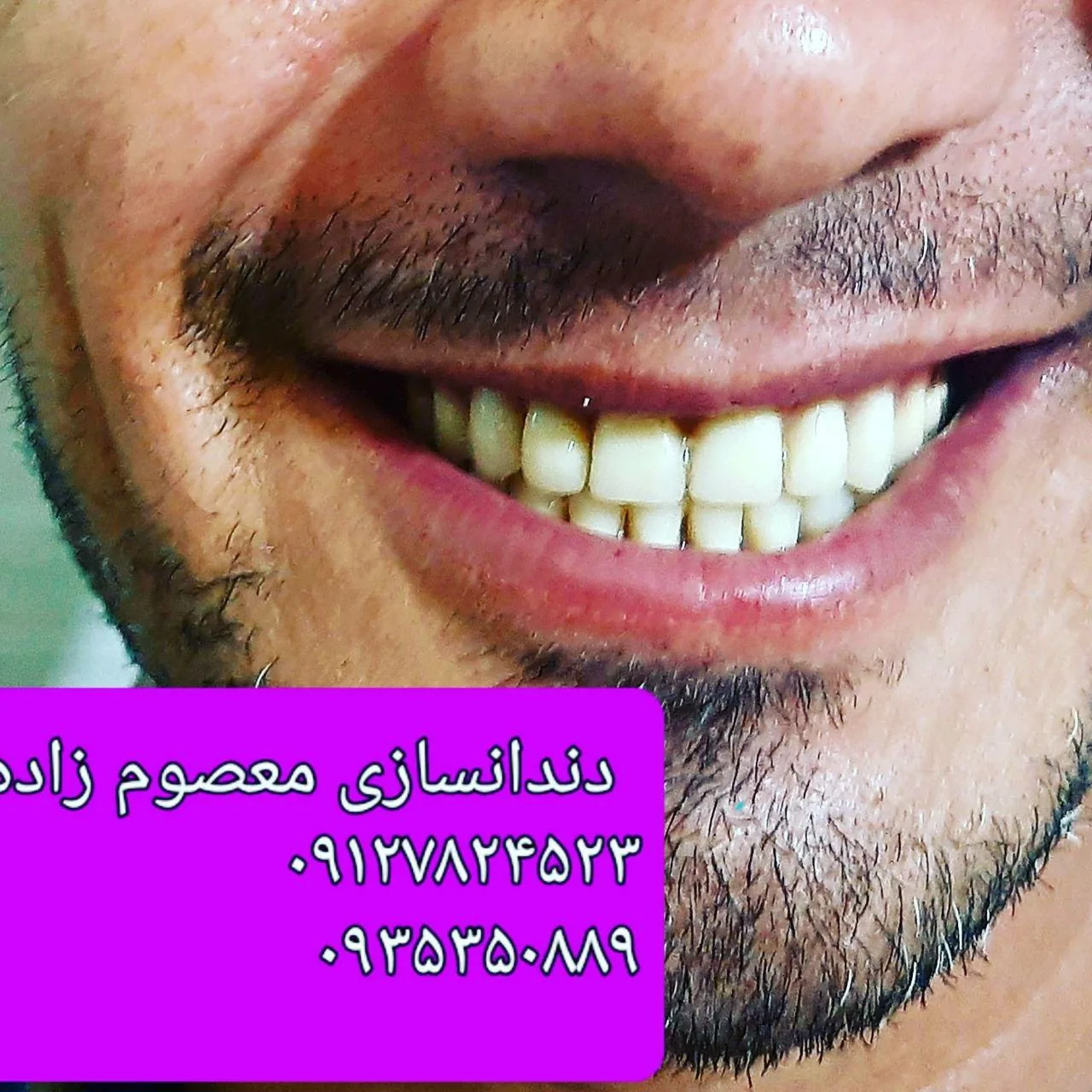 دندان سازی تخصصی معصوم زاده - دندانپزشک در قم