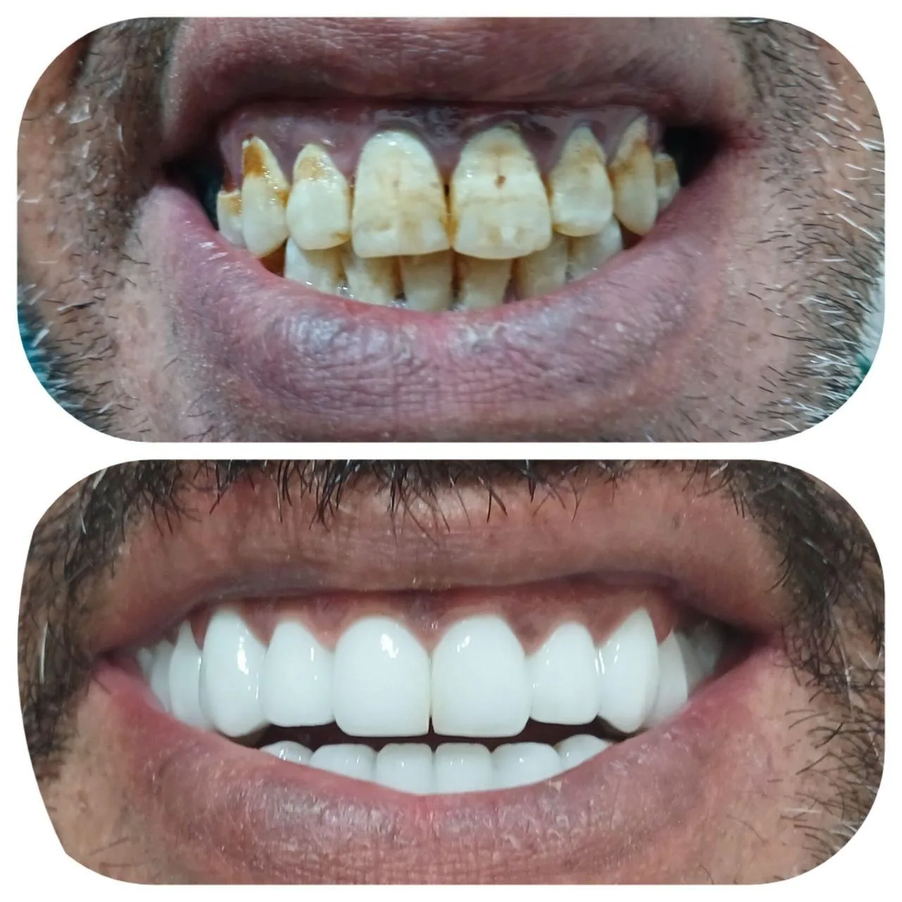 دندان سازی تخصصی معصوم زاده - دندانپزشک در قم - تصویر 4