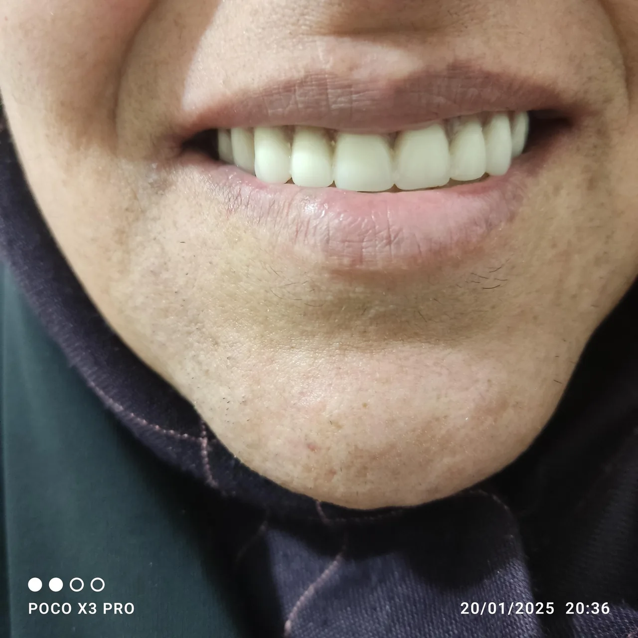 دندانسازی رستمی - تصویر 2