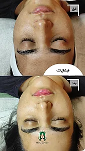 فیشال تخصصی مهسا مغانلو