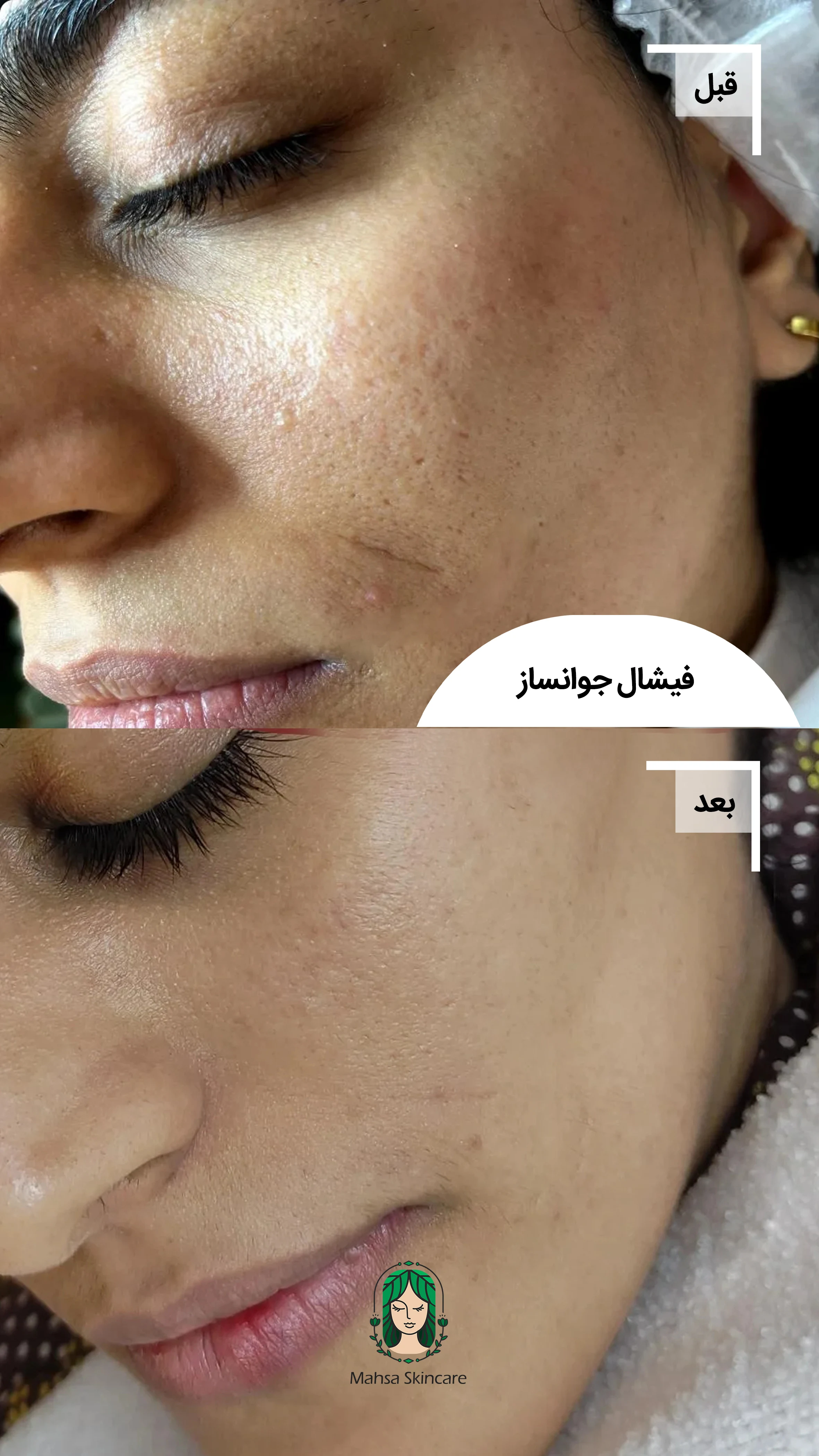 فیشال تخصصی مهسا مغانلو - تصویر 2