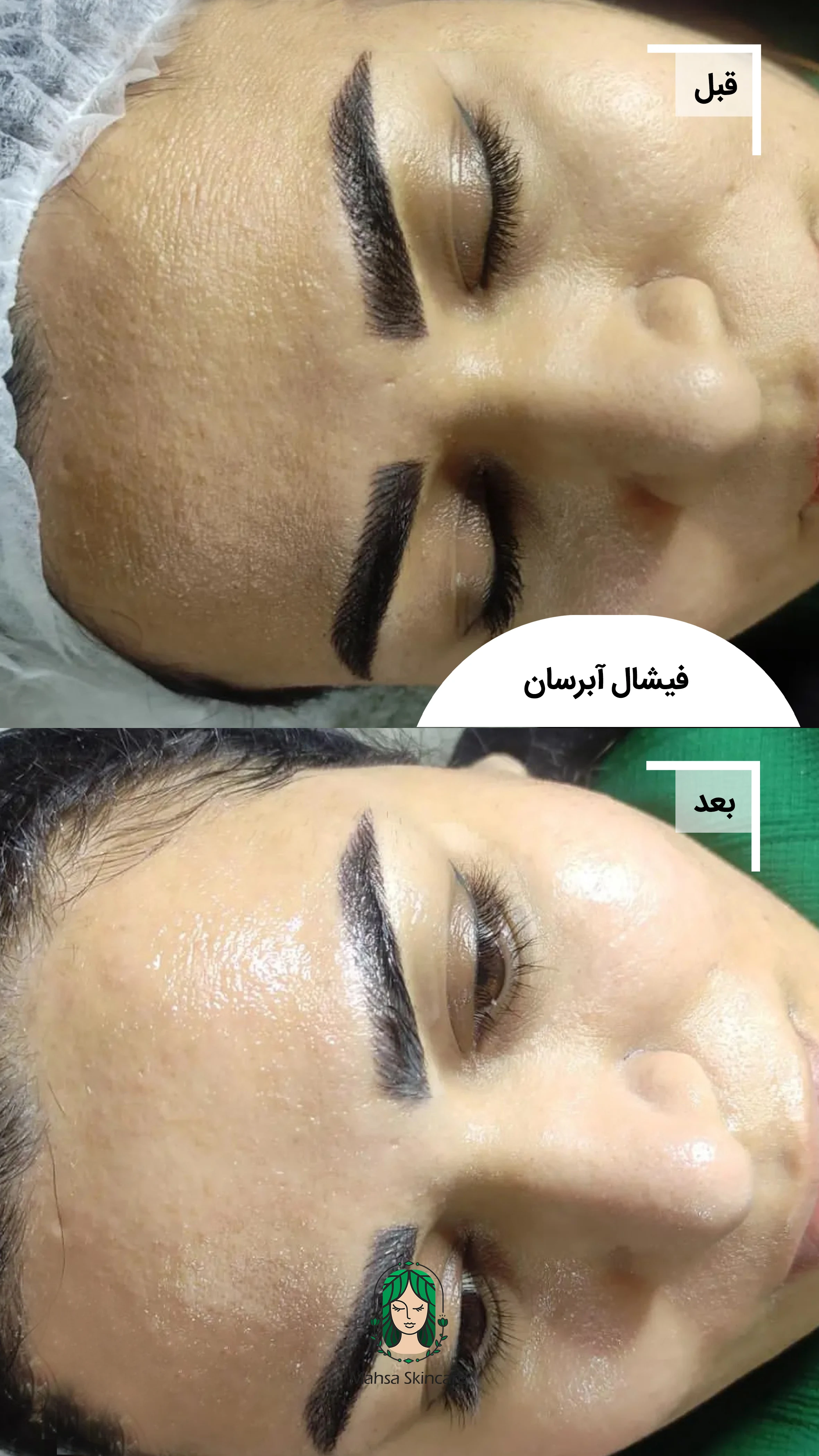 فیشال تخصصی مهسا مغانلو - تصویر 4