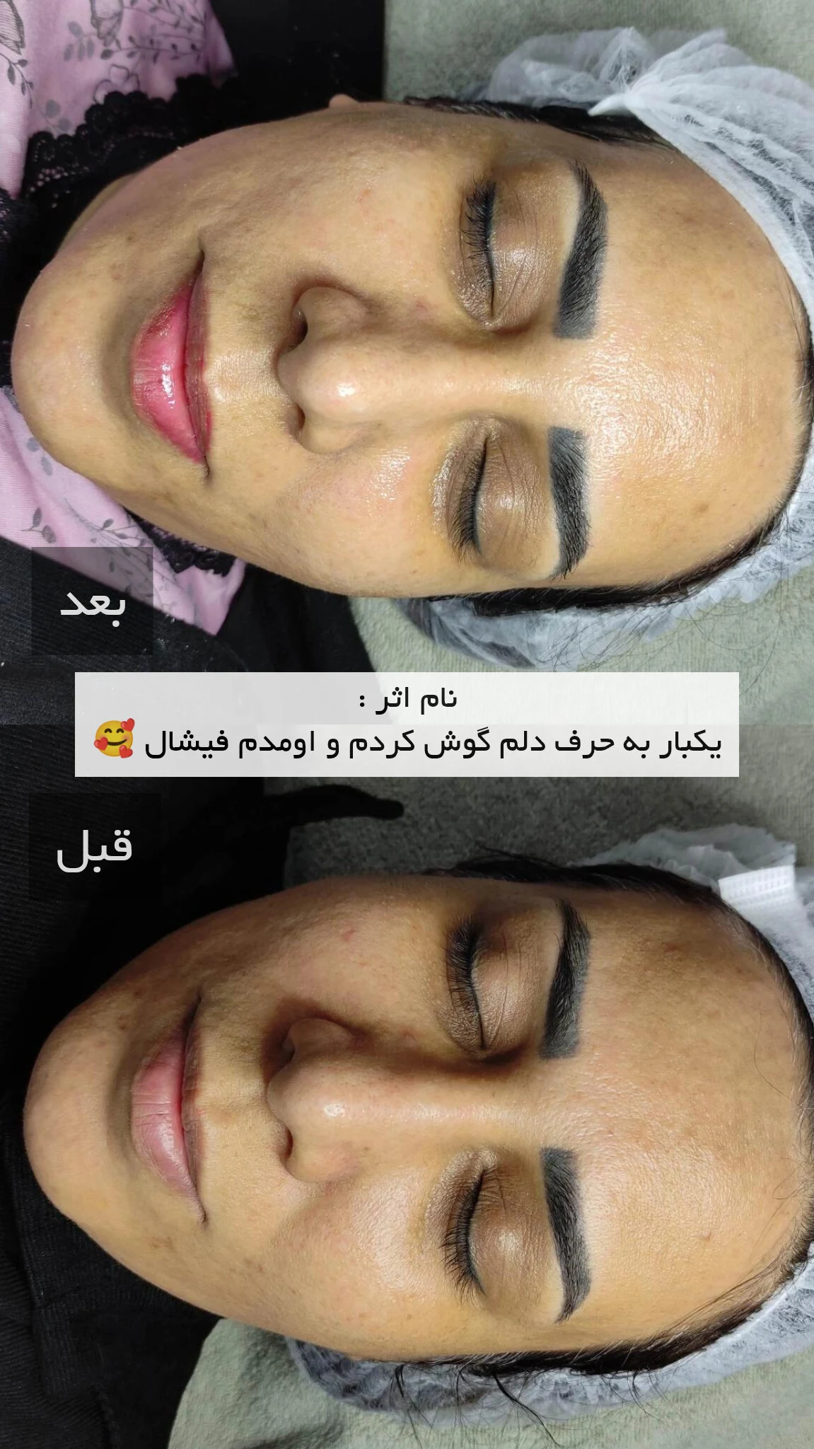 فیشال تخصصی مهسا مغانلو - تصویر 5