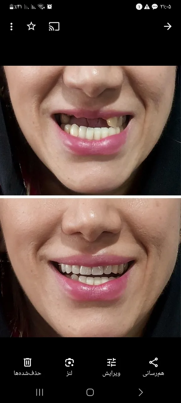 دندانسازی بنی هاشم - تصویر 3