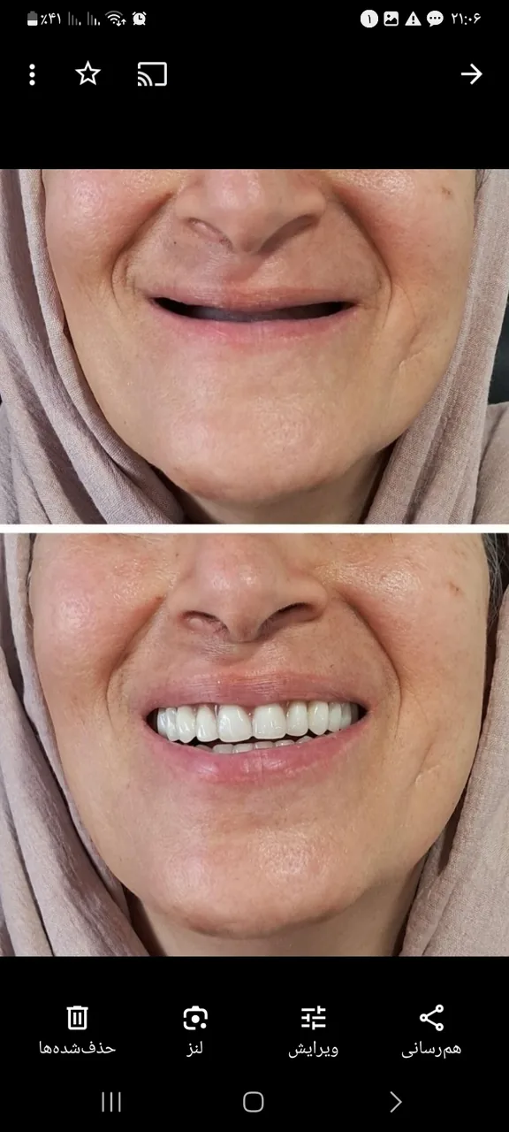 دندانسازی بنی هاشم - تصویر 4