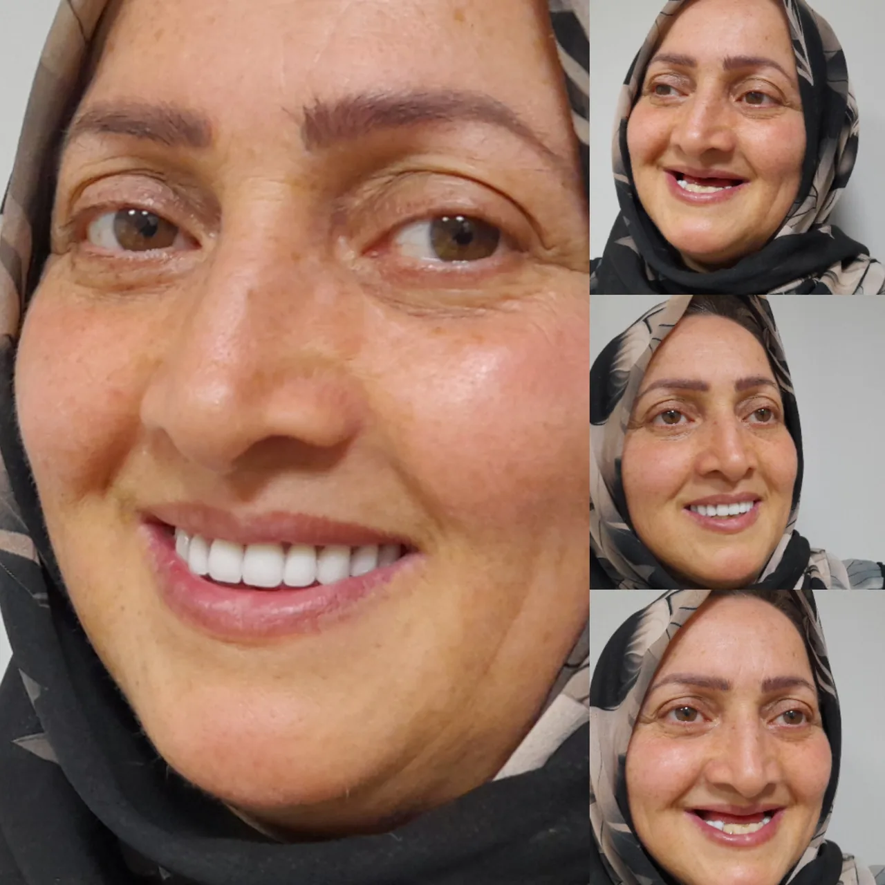 دندانسازی بنی هاشم - تصویر 5