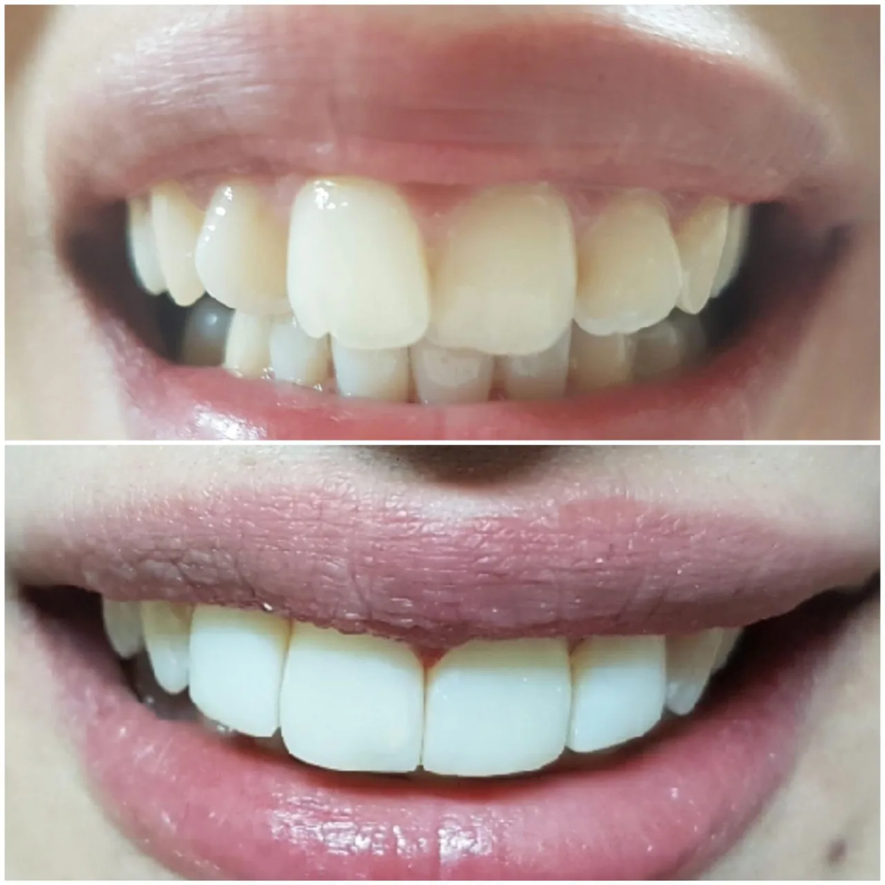 دکتر مجید غلامی جراح دندانپزشک زیبایی ایمپلنت - تصویر 2