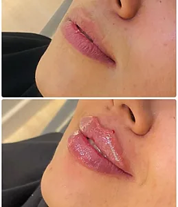کلینیک نورا ساراحسنی (پوست مو زیبایی)