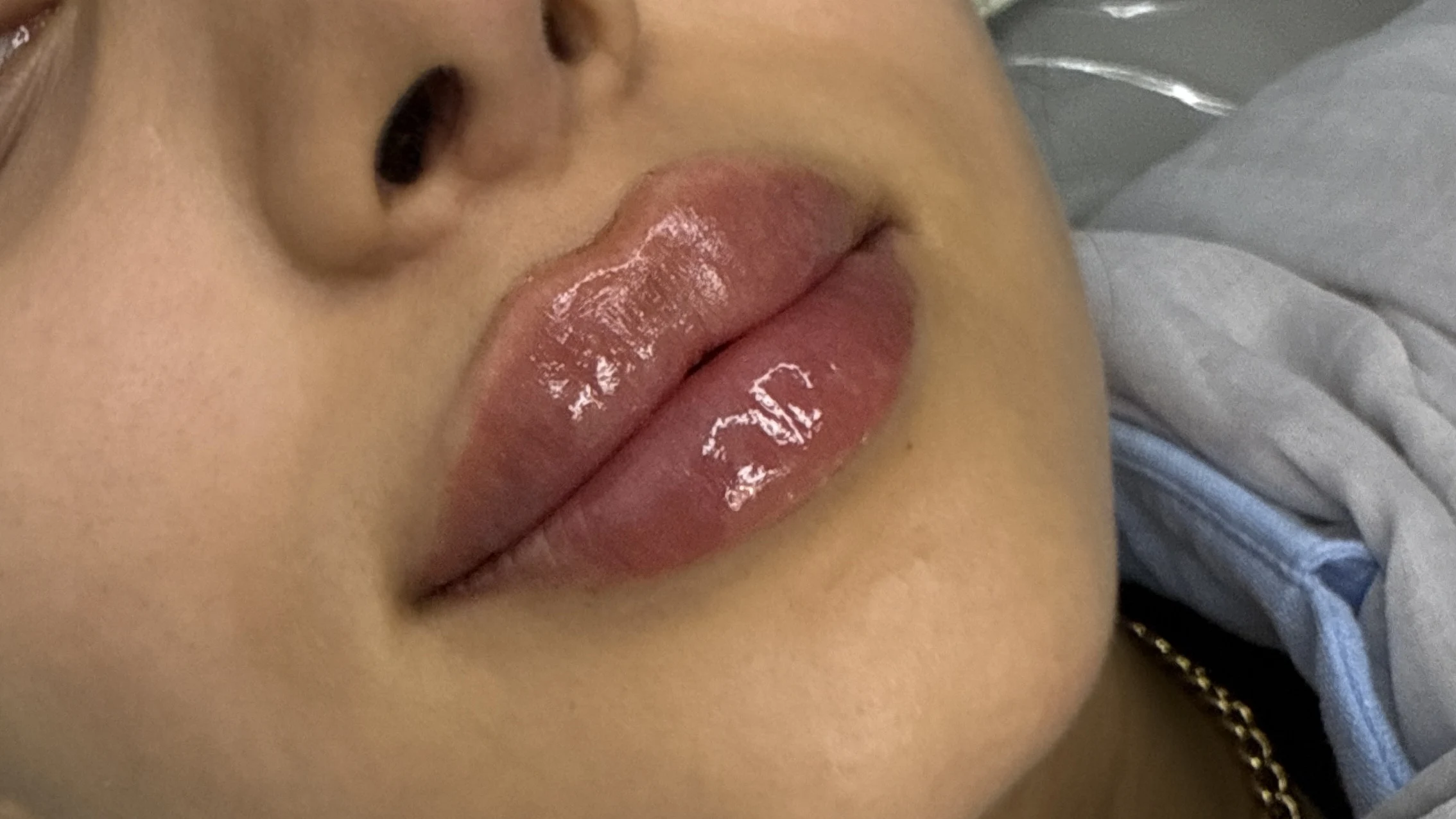 کلینیک زیبایی و لاغری الین