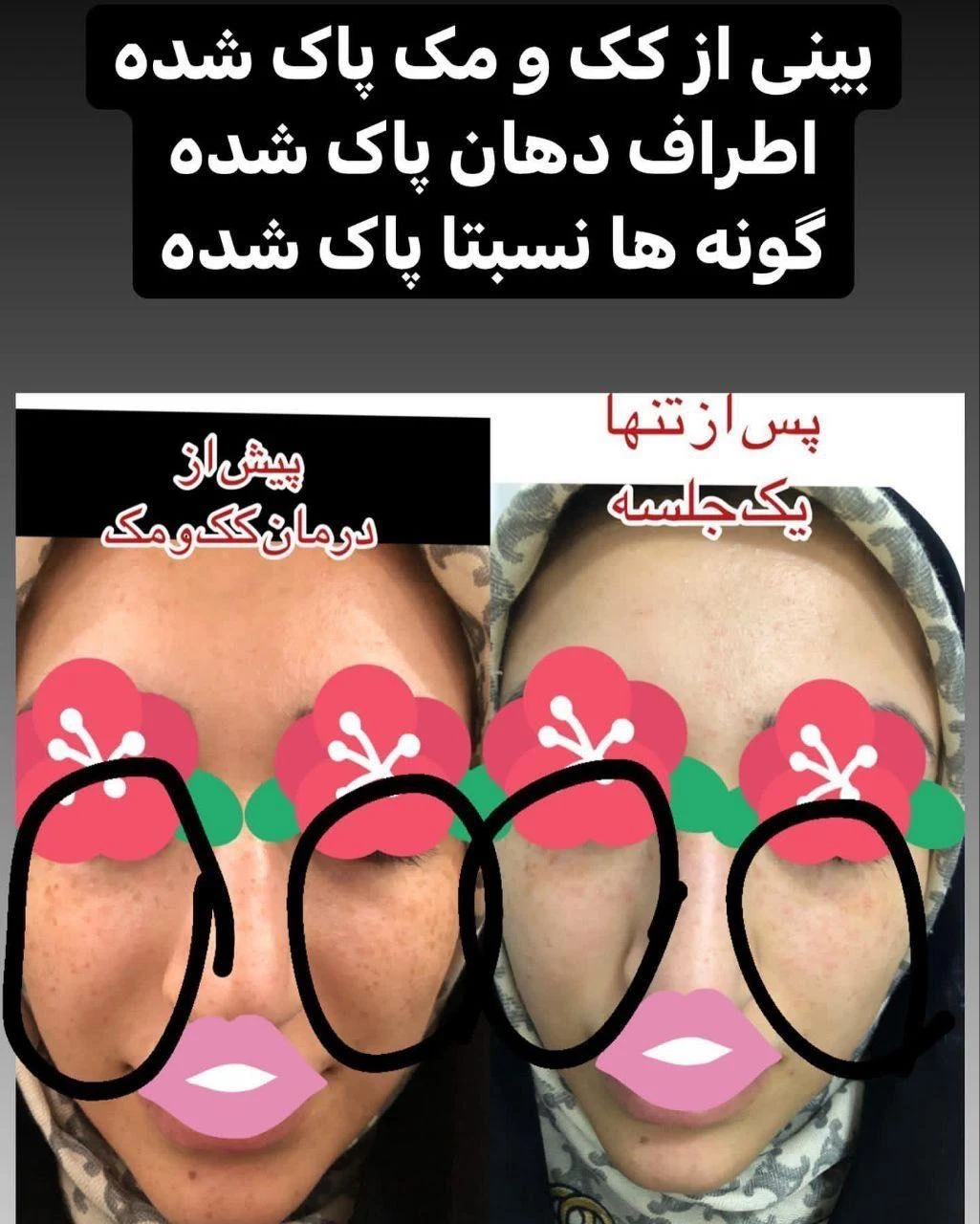 کلینیک زیبایی و لیزر دکتر سحر پارسایی - تصویر 3