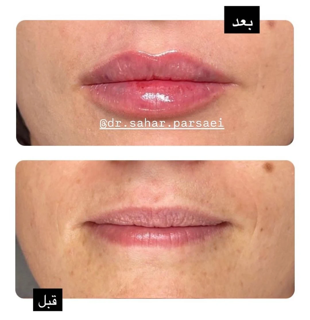 کلینیک زیبایی و لیزر دکتر سحر پارسایی - تصویر 4