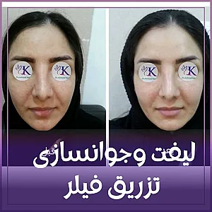 کلینیک پوست،لاغری ولیزردکتر شهرزاد کیانی