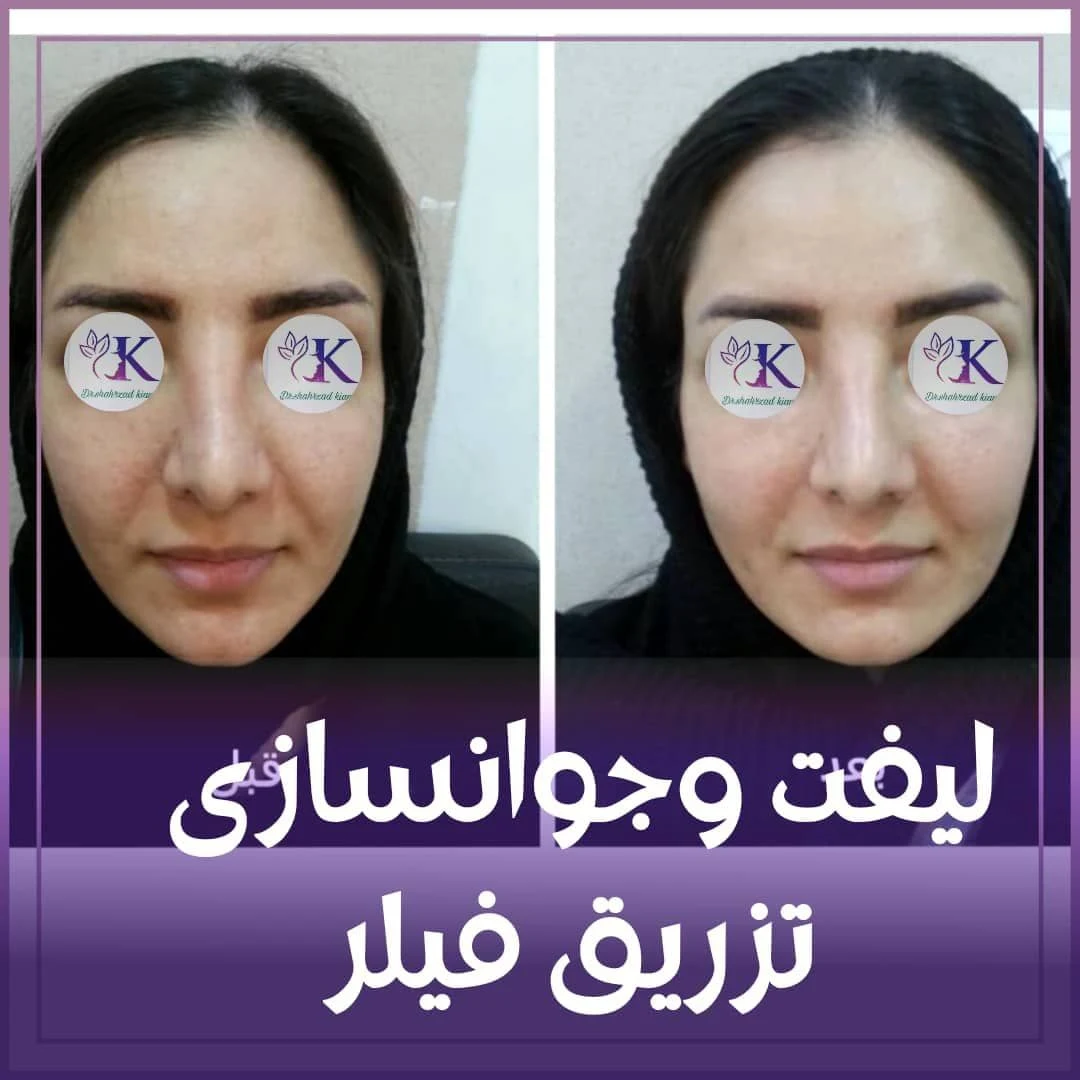 کلینیک پوست،لاغری ولیزردکتر شهرزاد کیانی