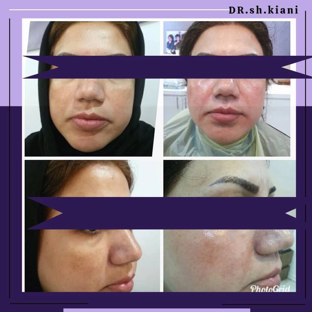 کلینیک پوست،لاغری ولیزردکتر شهرزاد کیانی - تصویر 3
