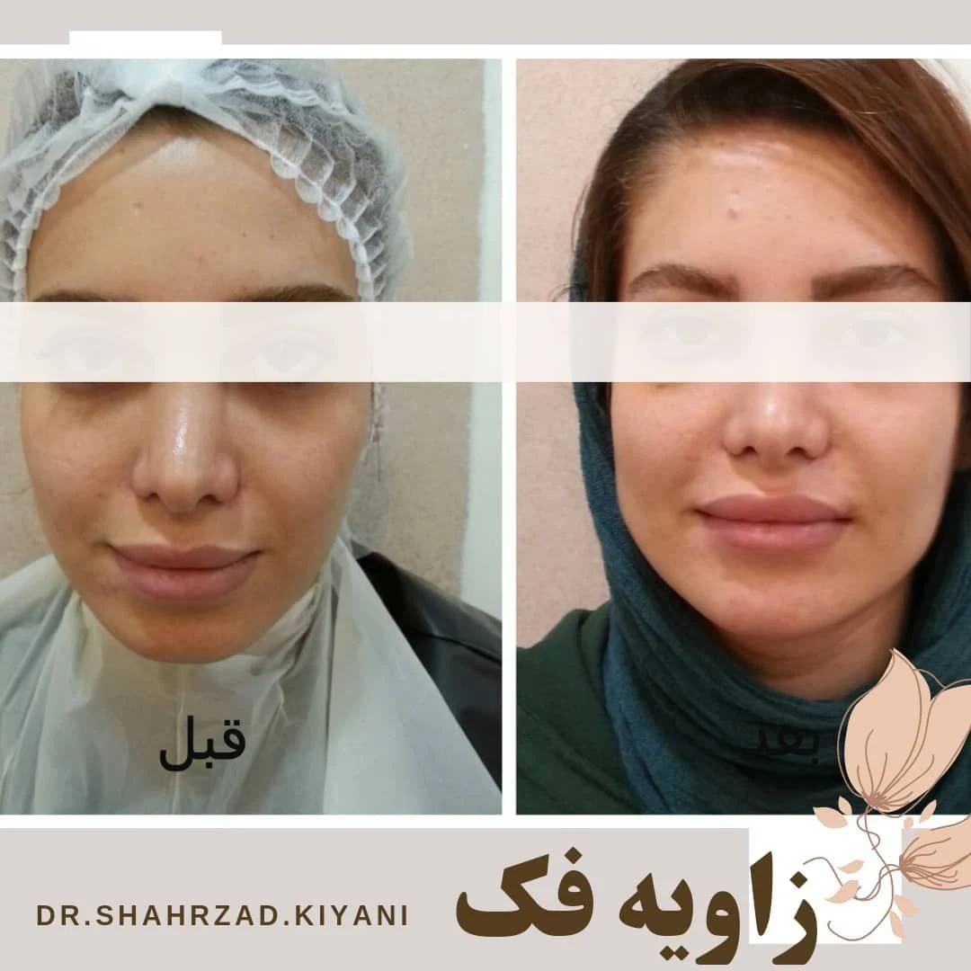 کلینیک پوست،لاغری ولیزردکتر شهرزاد کیانی - تصویر 4