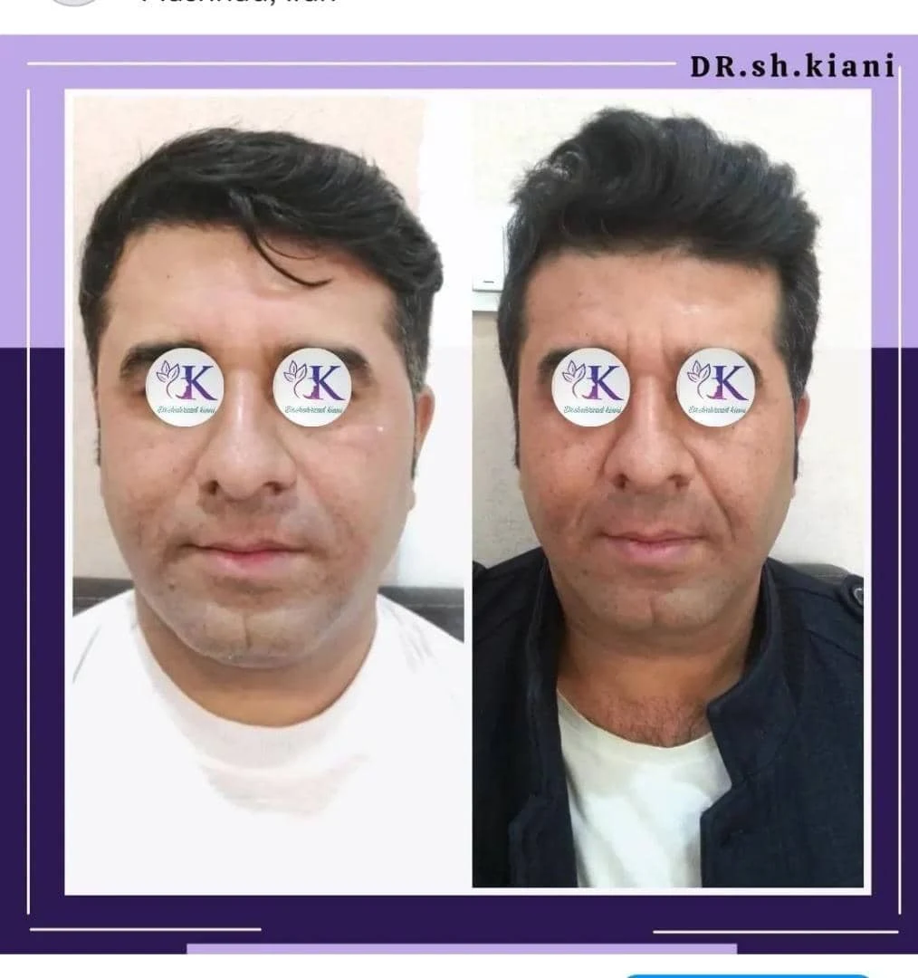 کلینیک پوست،لاغری ولیزردکتر شهرزاد کیانی - تصویر 5