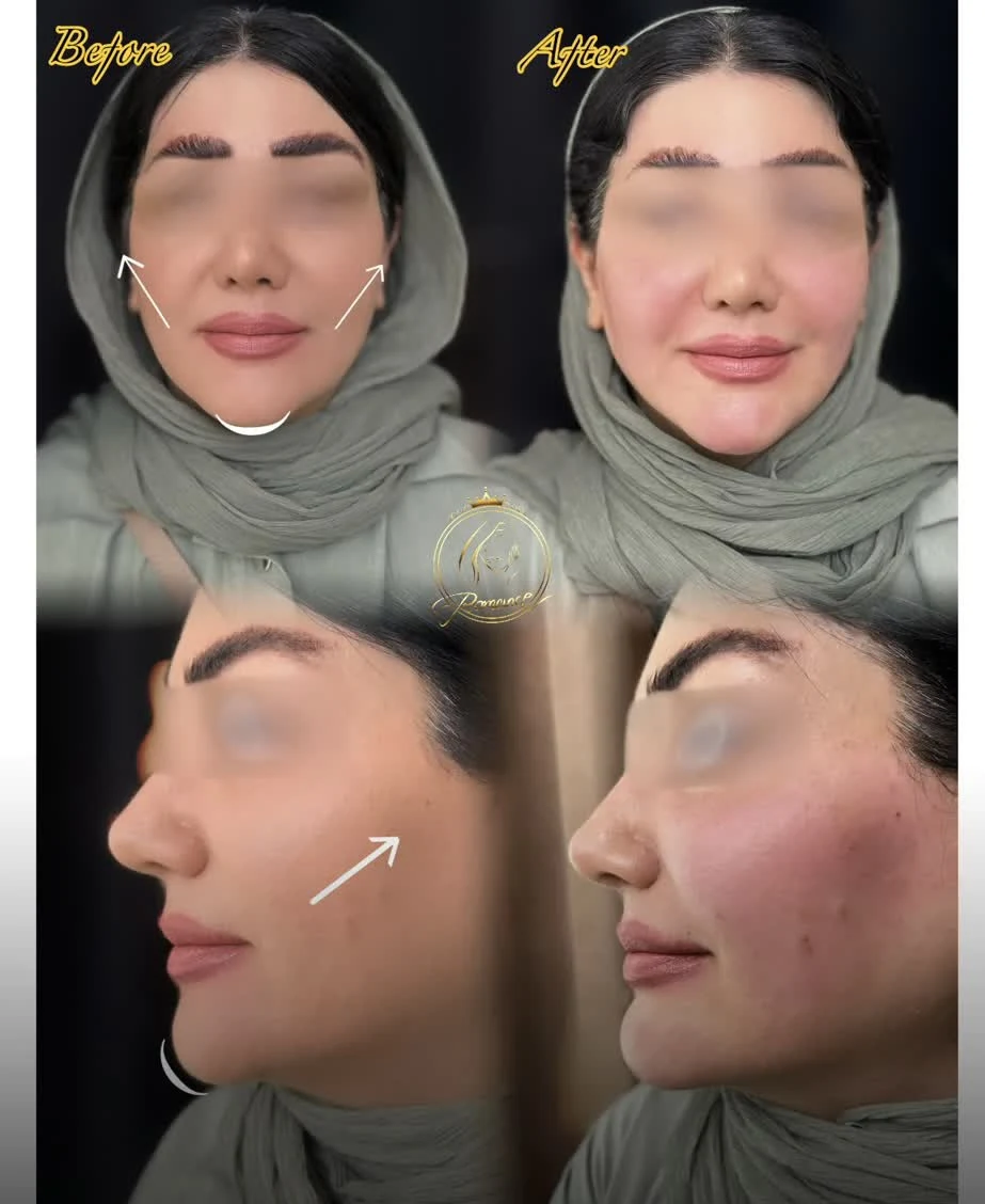 کلینیک زیبایی و پوست و مو رومنس - تصویر 3