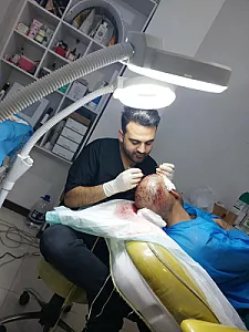 کلینیک کاشت مو صبحی