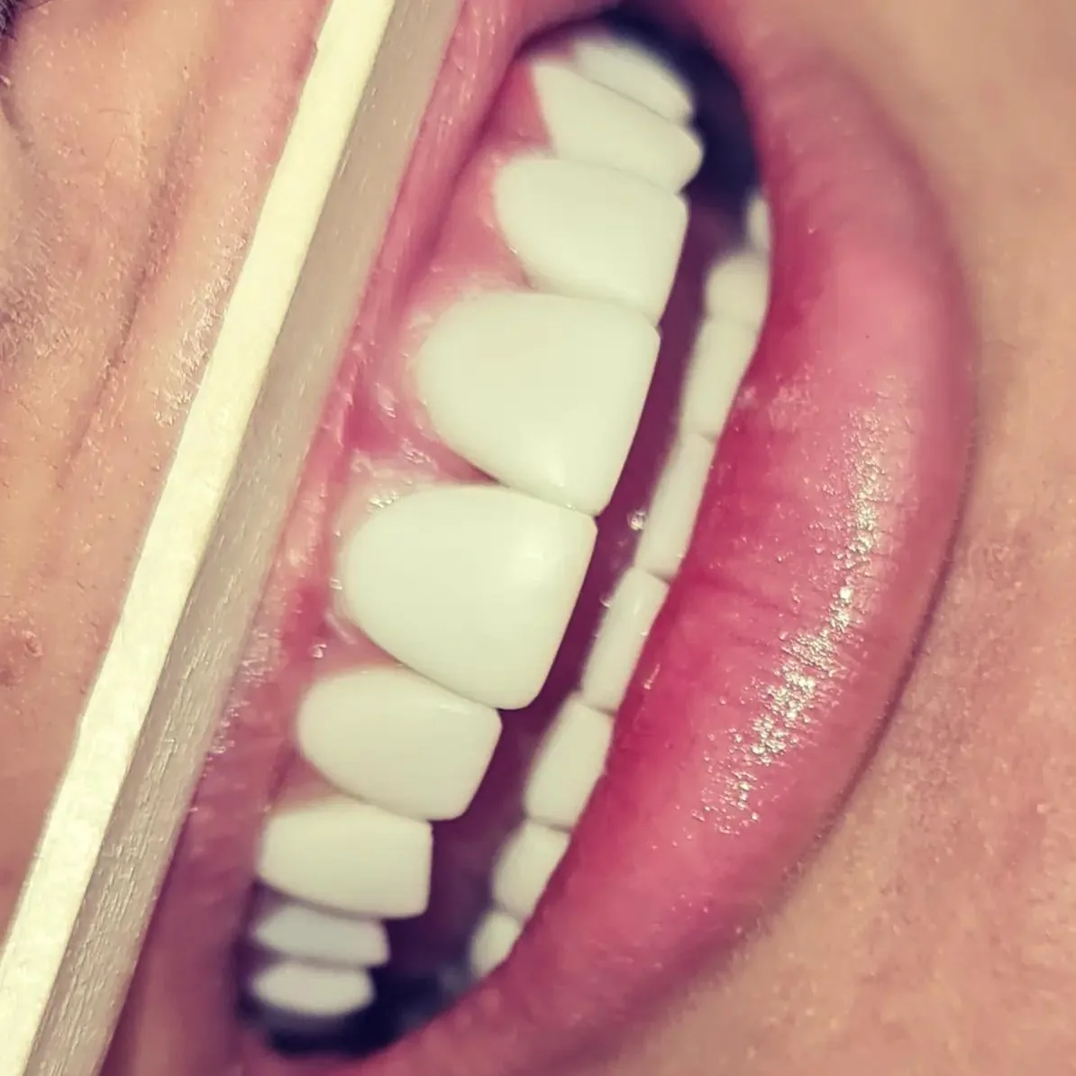 دندانپزشکی دکتر گلاره همتی