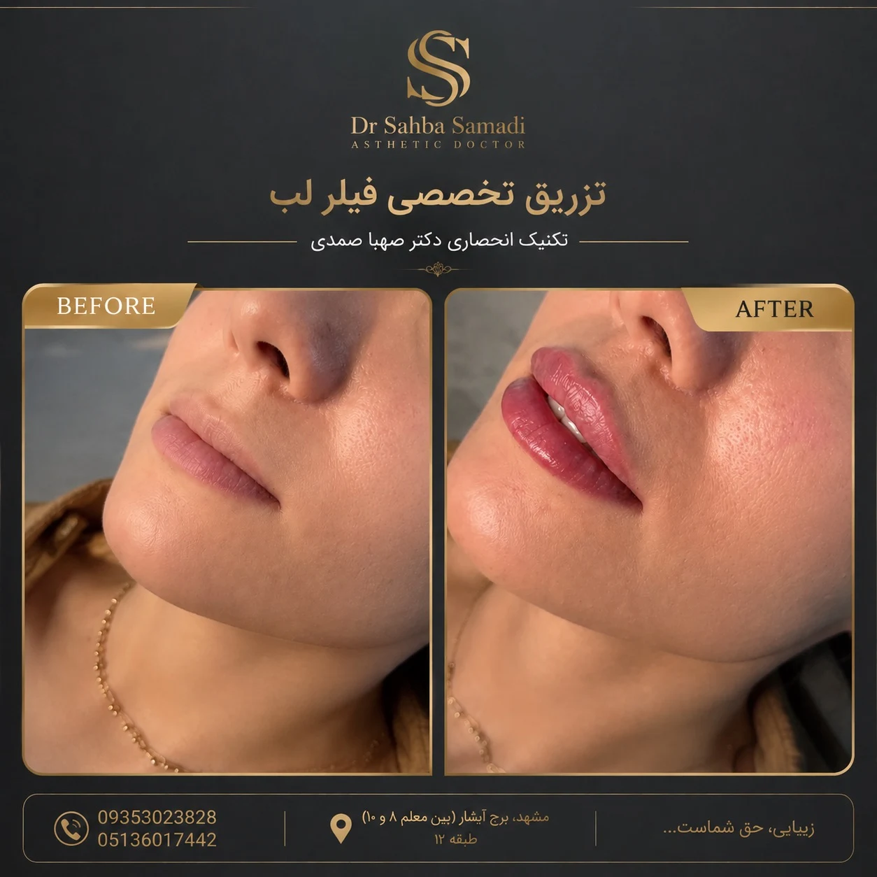 مطب پوست مو زیبایی لیزر دکترصهباصمدی - تصویر 2