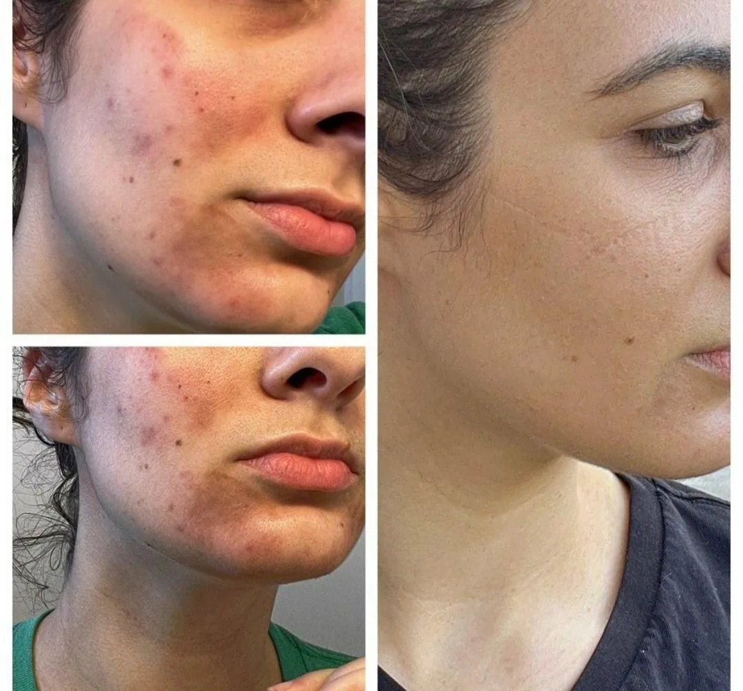 کلینیک پوست و مو زیبایی لوتوس