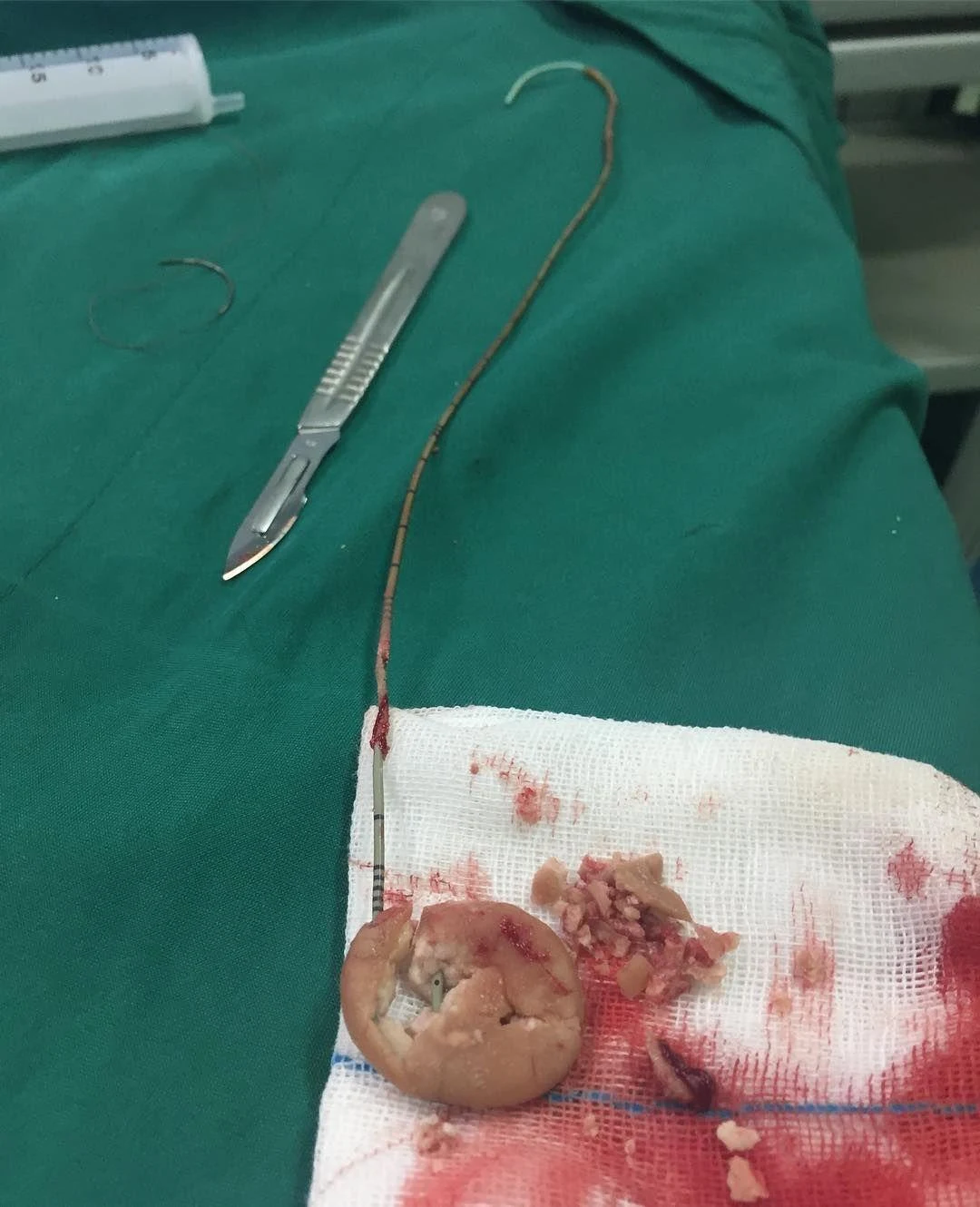 مطب دکتر علی طهرانچی - تصویر 2