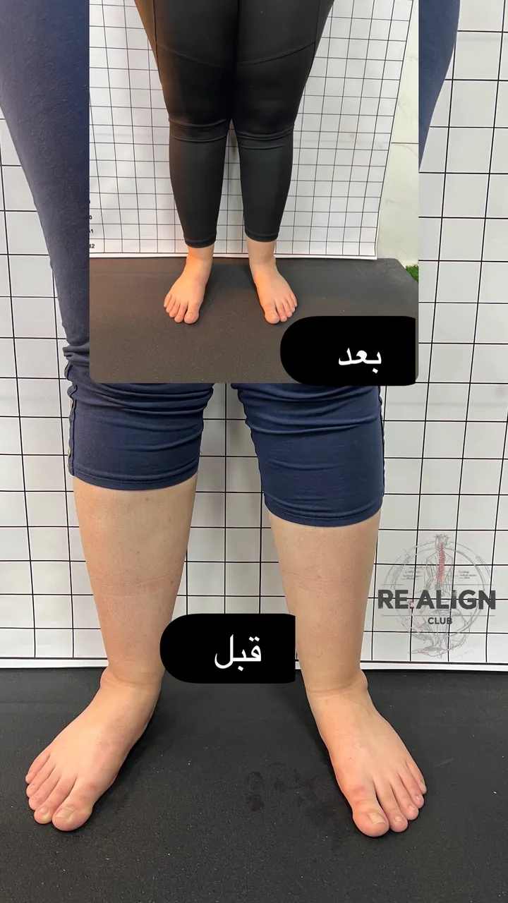 مرکز حرکات اصلاحی ری الاین - درمانگاه در ارومیه - تصویر 2