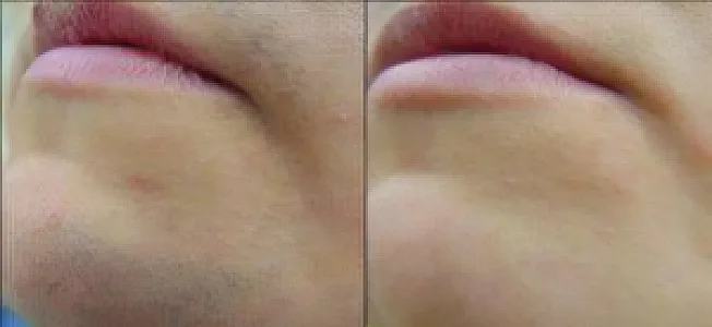 مرکز لیزر دانشور