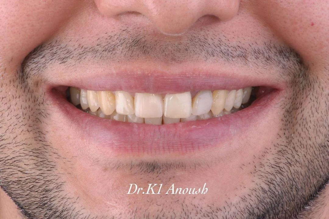 متخصص ارتودنسی دکتر کیوان انوش
