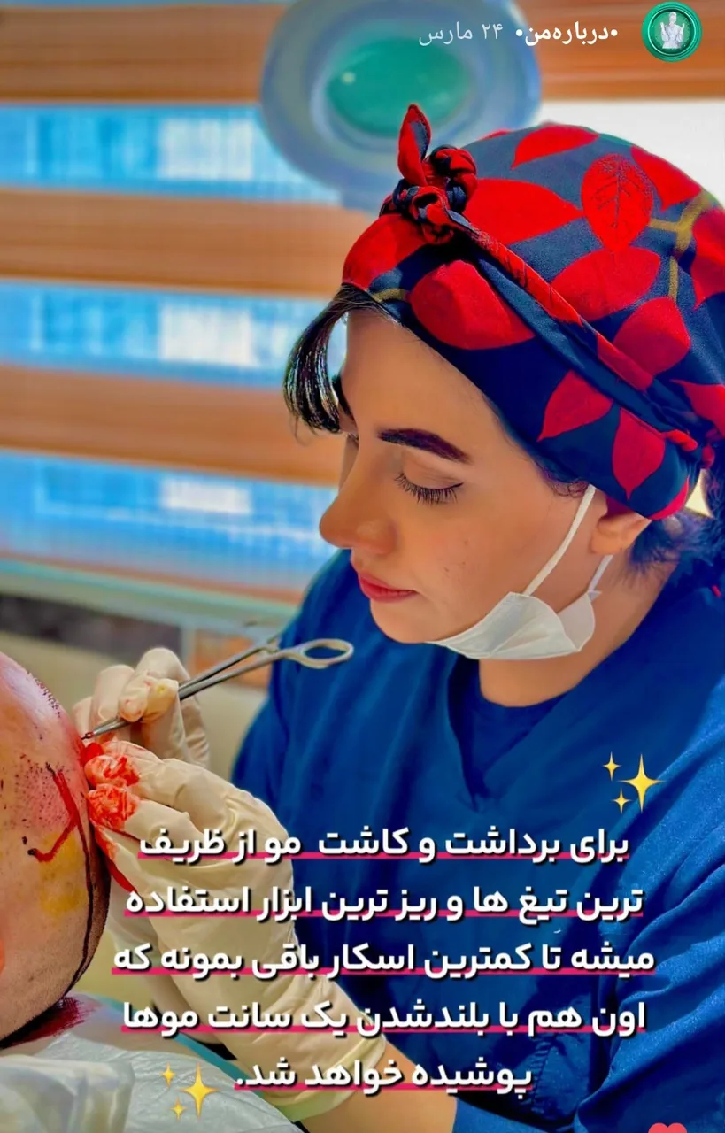 کاشت و پیوند مو و ابروی طبیعی - تصویر 4