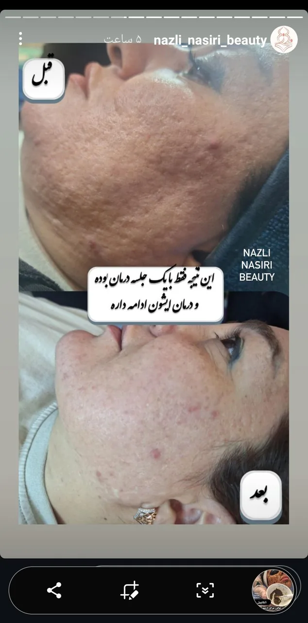 مرکز فیشیال آرزو نظیفی - تصویر 5