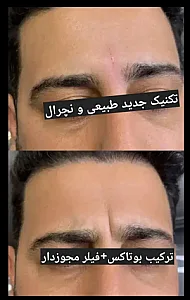 دکتر فروغ نجفی مرکز لیزر و زیبایی