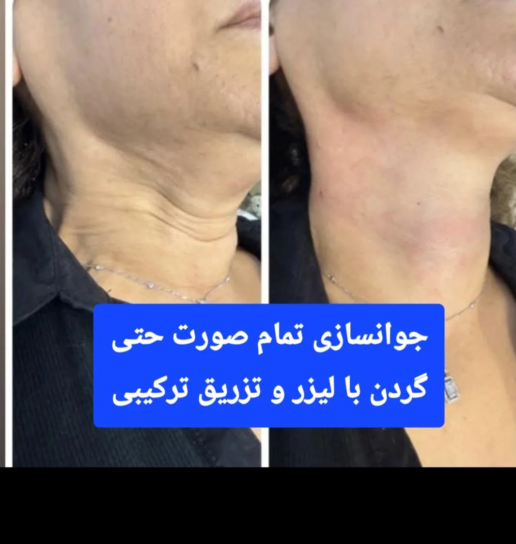 دکتر فروغ نجفی مرکز لیزر و زیبایی - تصویر 2