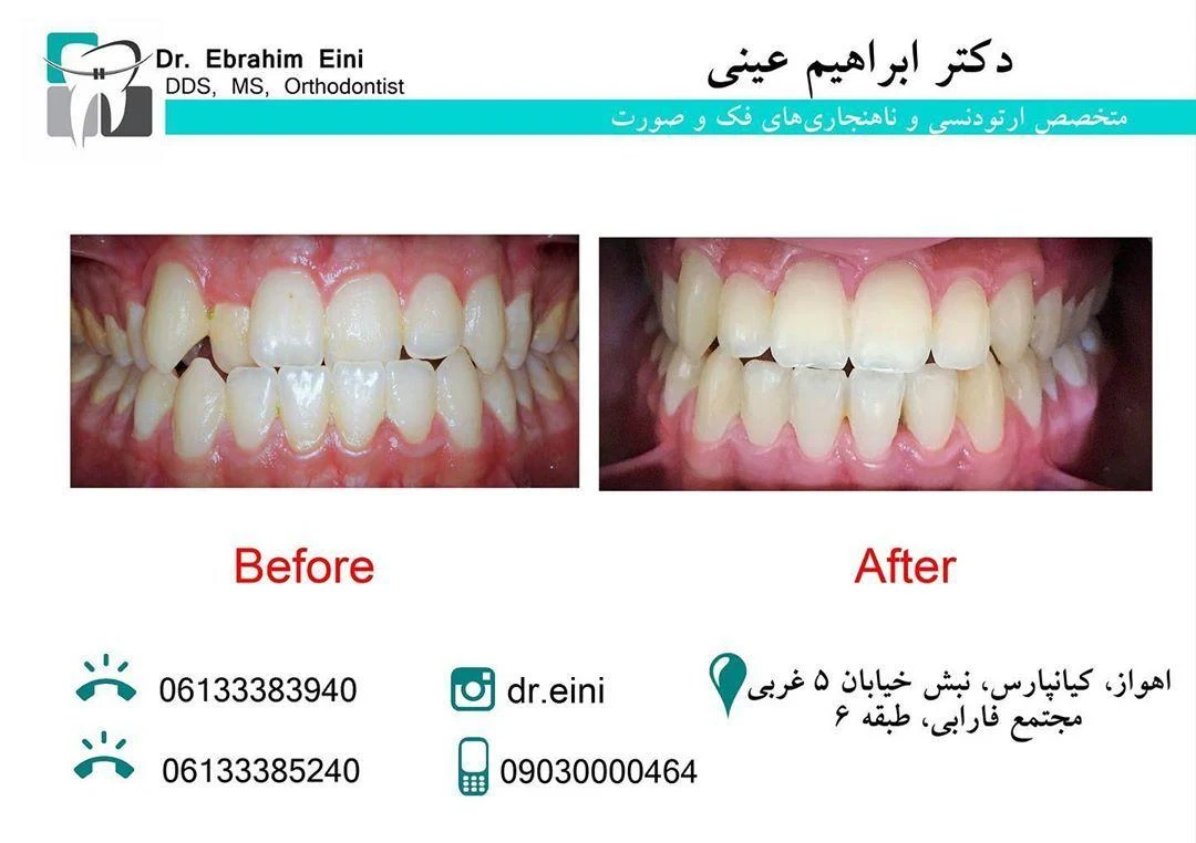 ارتودنسی اهواز دکتر ابراهیم عینی - تصویر 3