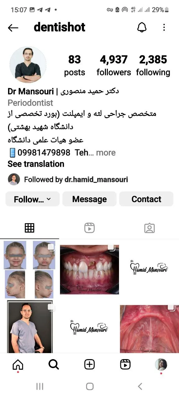 دکتر سلمان ابوالفضلی متخصص جراحی لثه و ایمپلنت - تصویر 3