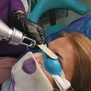 مطب لیزر دکتر افراخته